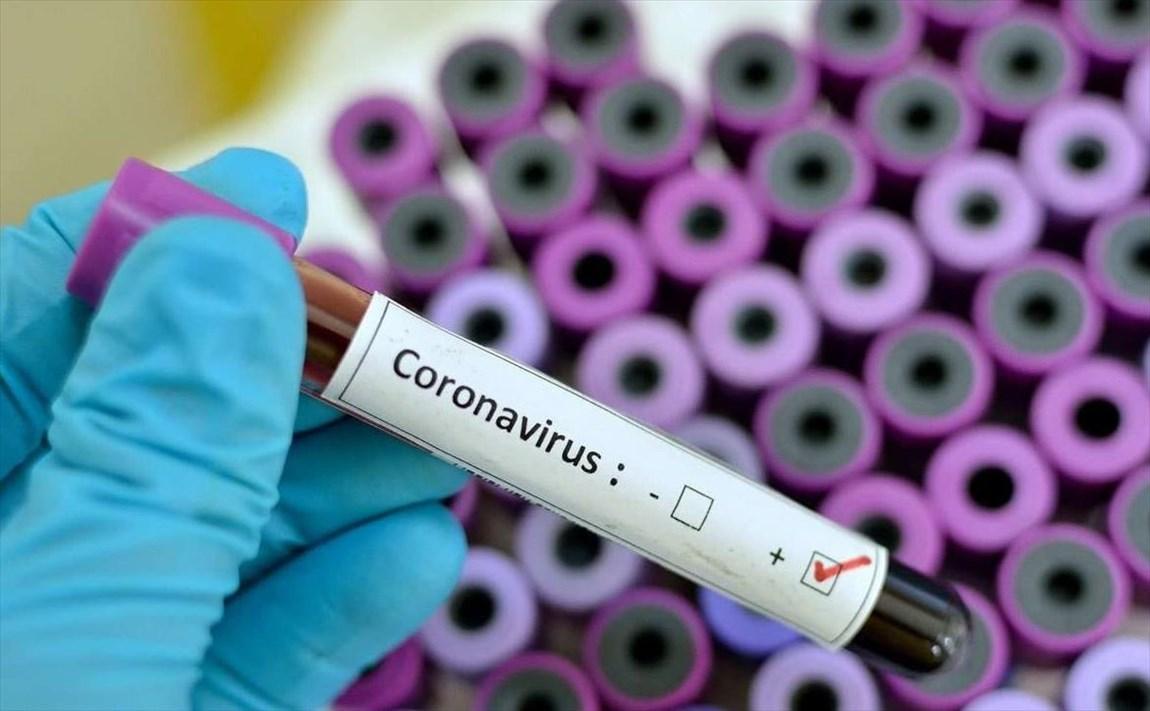 آسوشیتدپرس: مقامات آمریکا در واکنش به ویروس کرونا عقب بوده اند